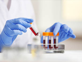 lab monitoring